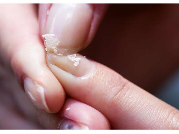 Sos! Help For Dry, Brittle Nails: Restoring Moisture & Strength